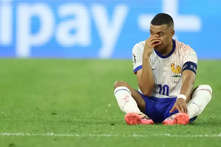 Kylian Mbappe Patah Hidung pada waktu Euro 2024, Kenali Risiko Komplikasi yang tersebut yang dimaksud Bisa Tercapai